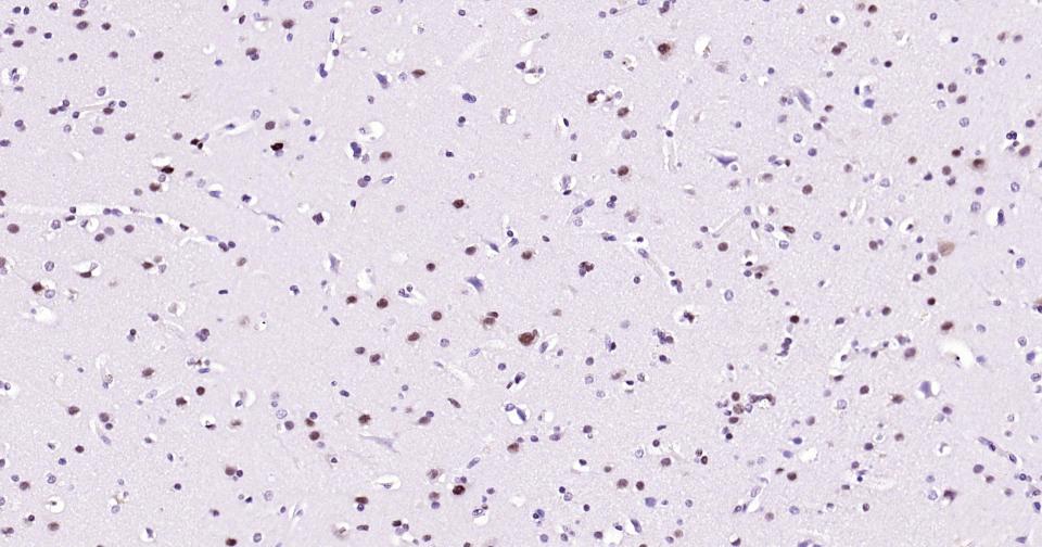 抑癌基因SNF2β重组兔单抗