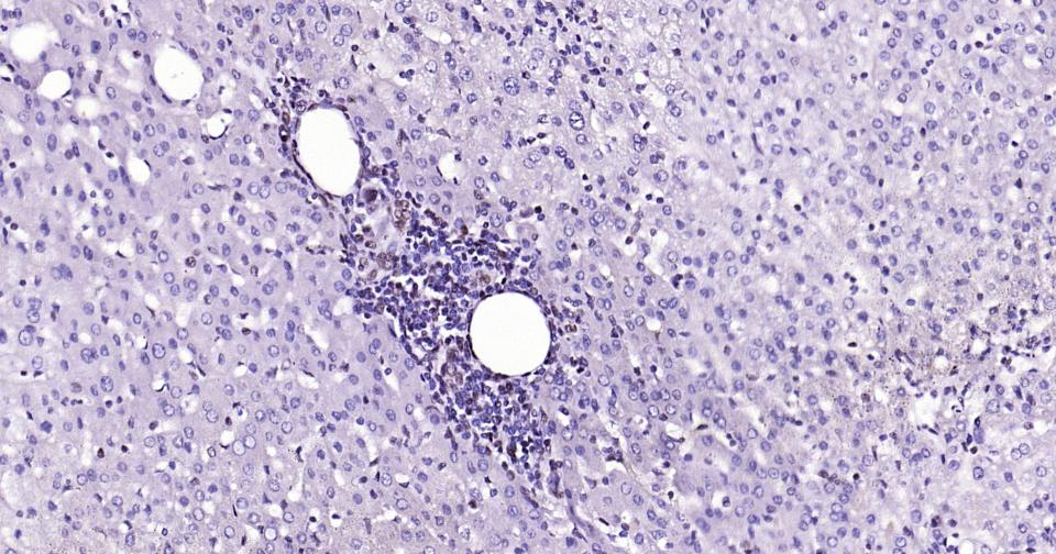 抑癌基因SNF2β重组兔单抗