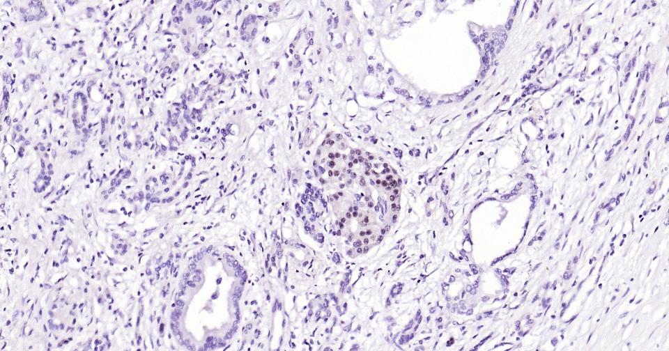 转录因子Pax6重组兔单抗