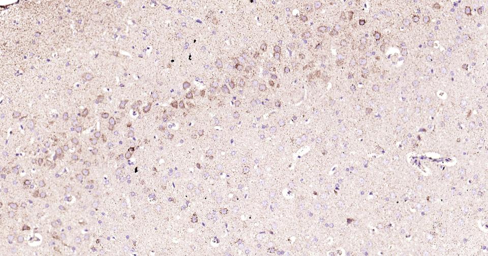 γ氨基丁酸转氨酶重组兔单抗