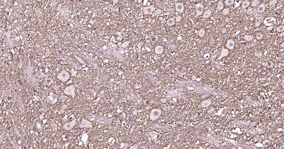 γ氨基丁酸运载蛋白1重组兔单抗