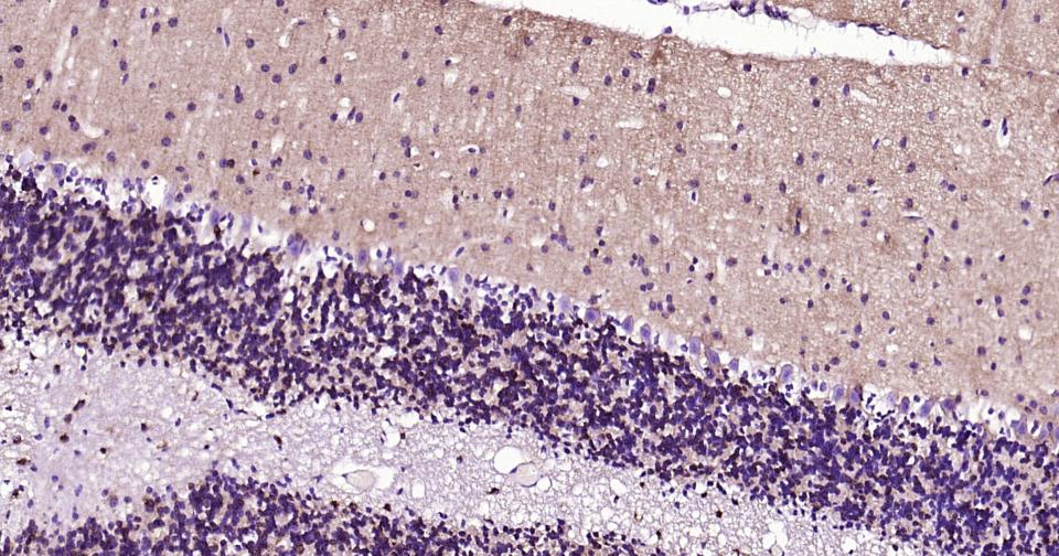 微管蛋白β1（内参）重组兔单抗