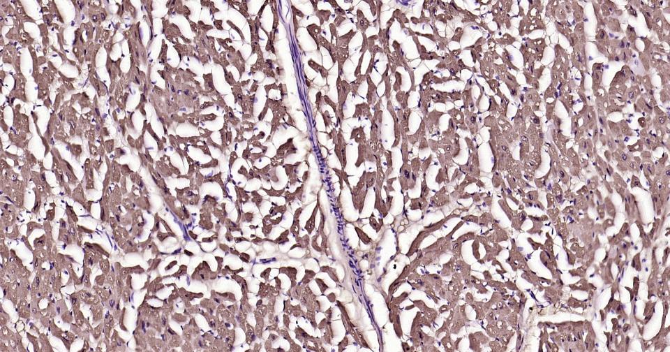 S100A1重组兔单抗-bsm-63044R