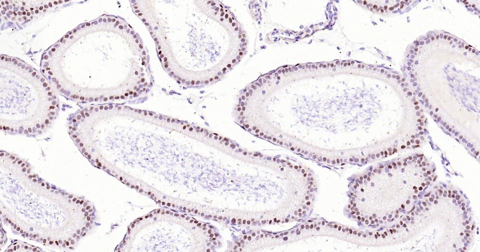 转录因子SOX9蛋白重组兔单抗