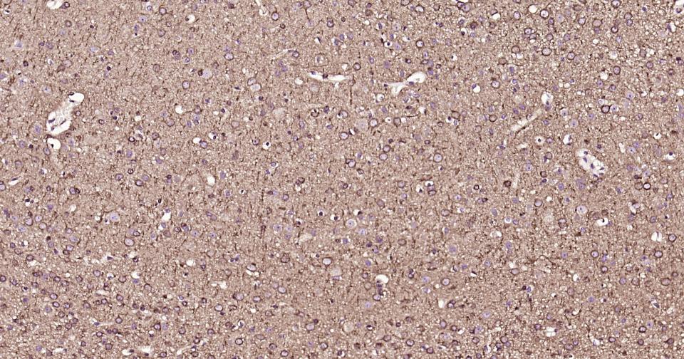 微管蛋白β1（内参）重组兔单抗