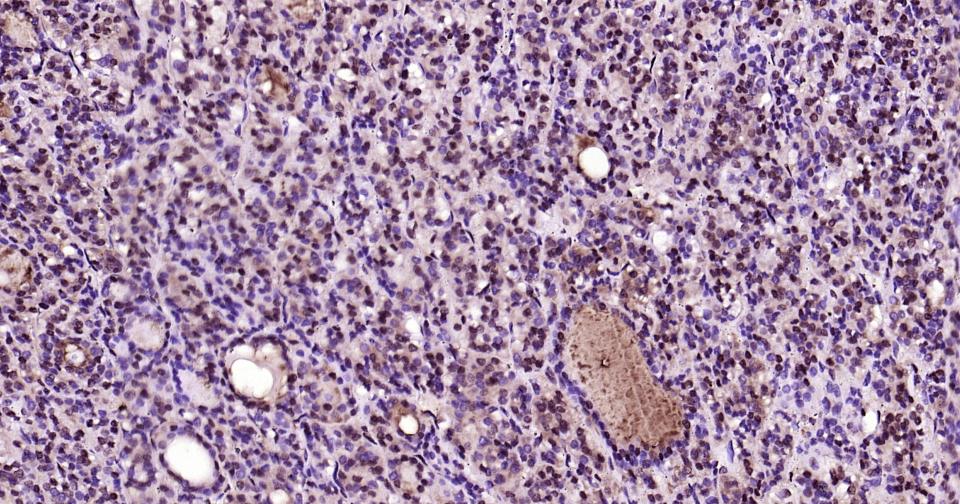 转录因子HES-1重组兔单抗-bsm-52568R