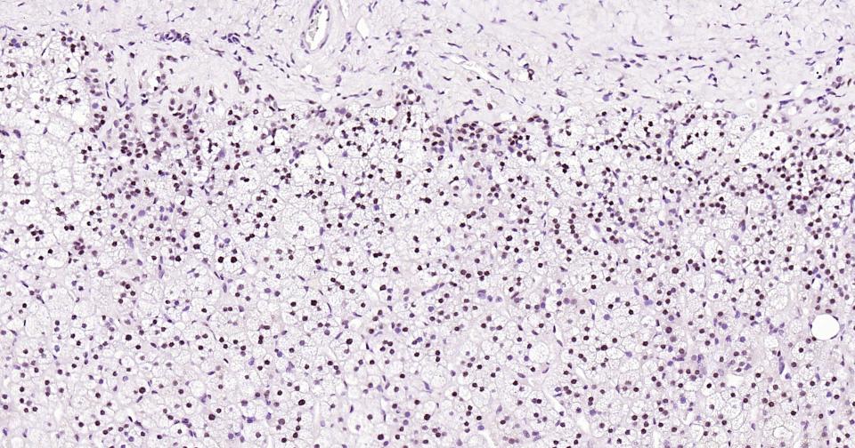 胰岛素基因增强结合蛋白1重组兔单抗