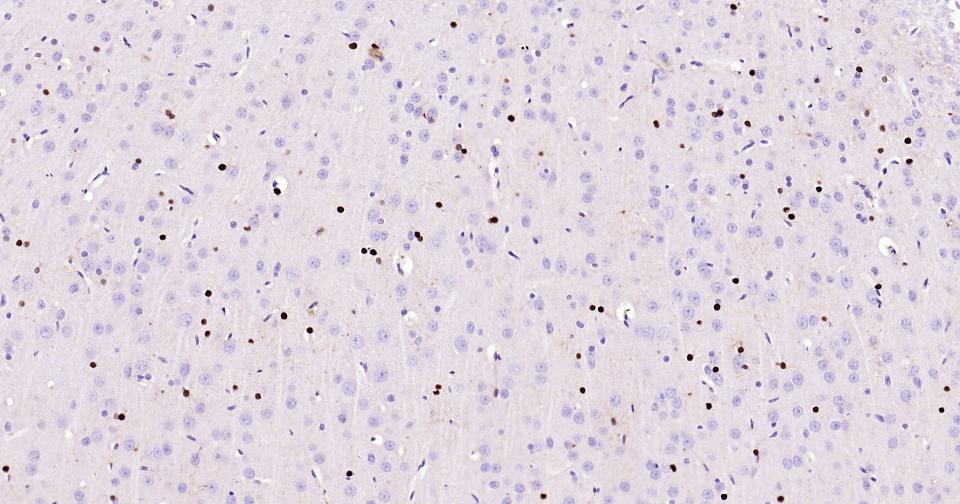 转录因子SOX9蛋白重组兔单抗