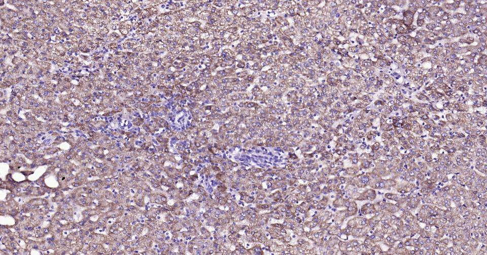 γ氨基丁酸转氨酶重组兔单抗