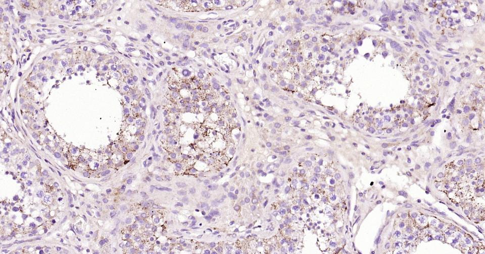 γ氨基丁酸转氨酶重组兔单抗