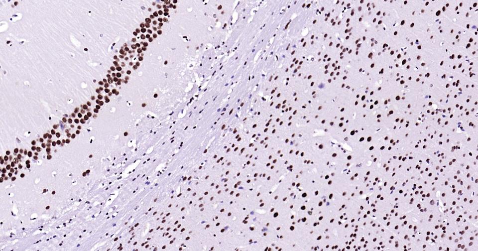 抑癌基因SNF2β重组兔单抗