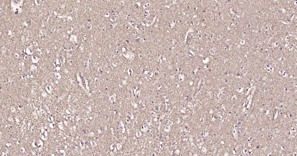 微管蛋白β1（内参）重组兔单抗