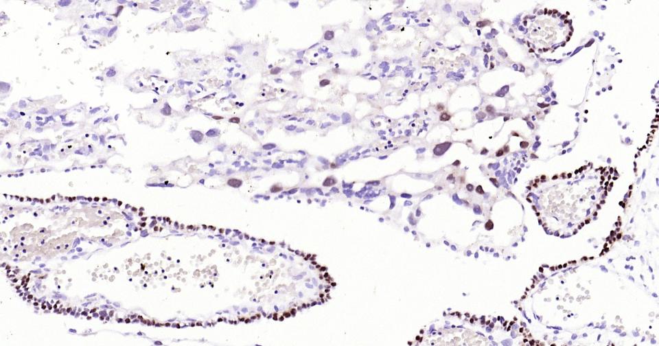 转录因子SOX9蛋白重组兔单抗
