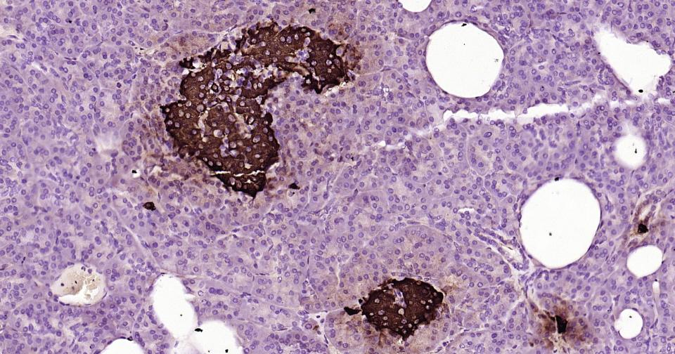 跨膜受体蛋白Notch-1重组兔单抗