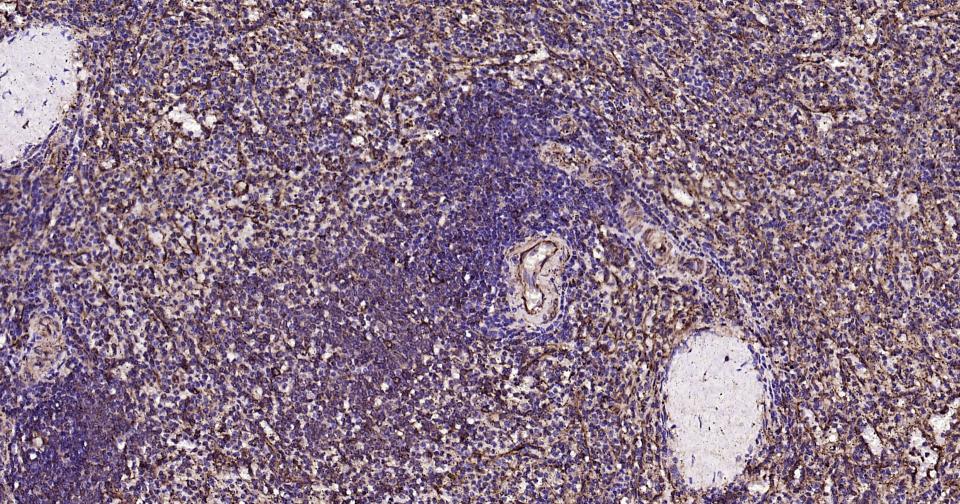 微管蛋白β1（内参）重组兔单抗