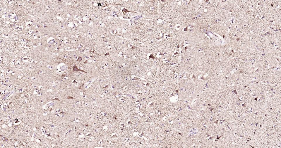 γ氨基丁酸转氨酶重组兔单抗