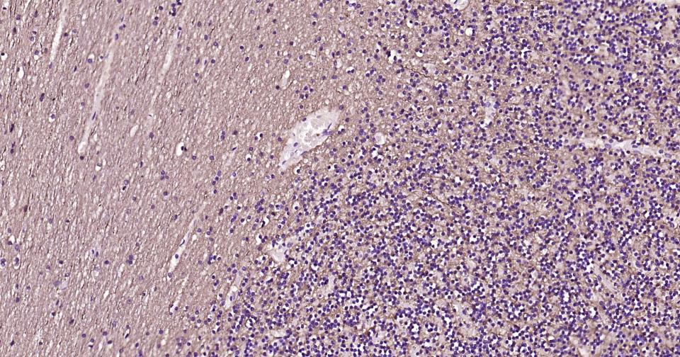 2’,3’-环腺苷酸-3’-磷酸二酯酶重组兔单抗-bsm-61411R