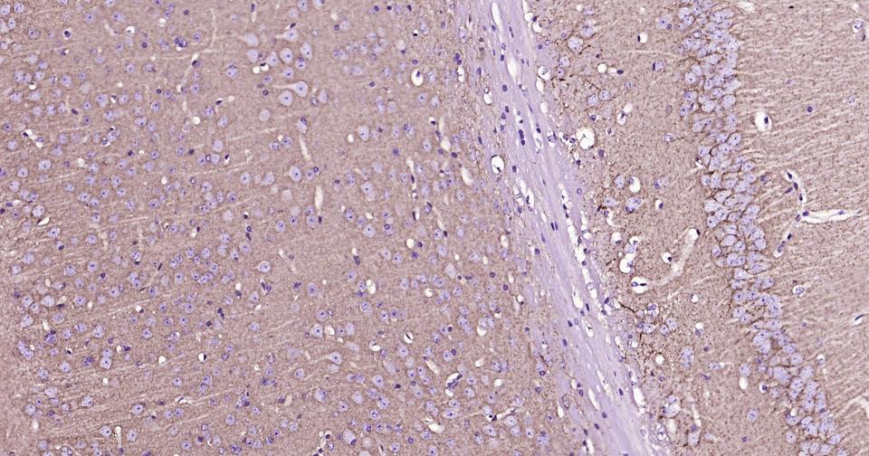 γ氨基丁酸运载蛋白1重组兔单抗