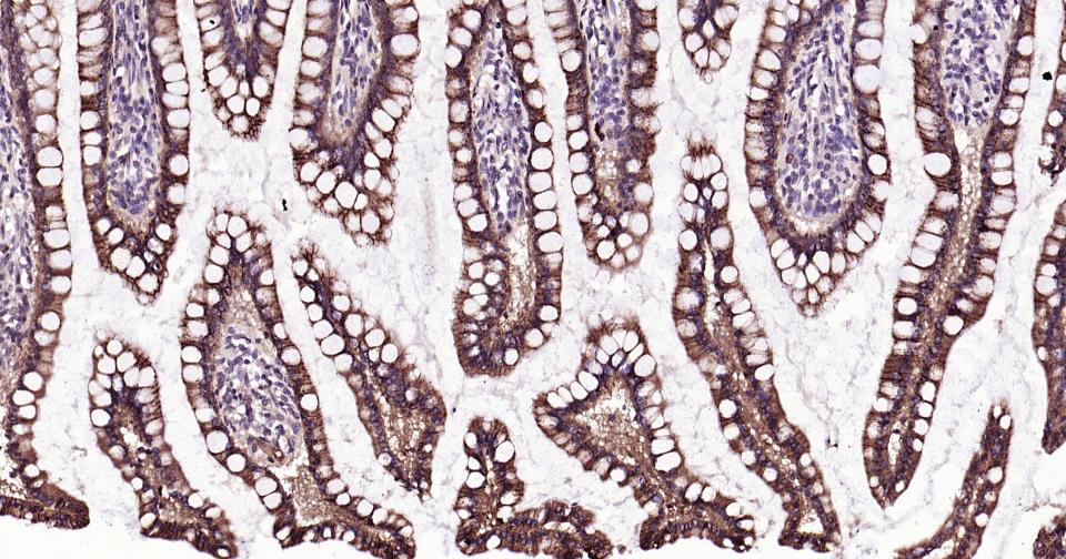 上皮钙粘附分子重组兔单克隆抗体