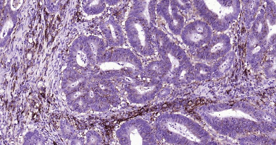 CD44抗体重组兔单抗