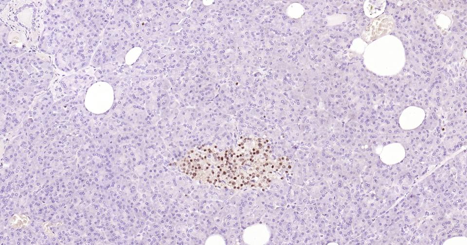 转录因子Pax6重组兔单抗