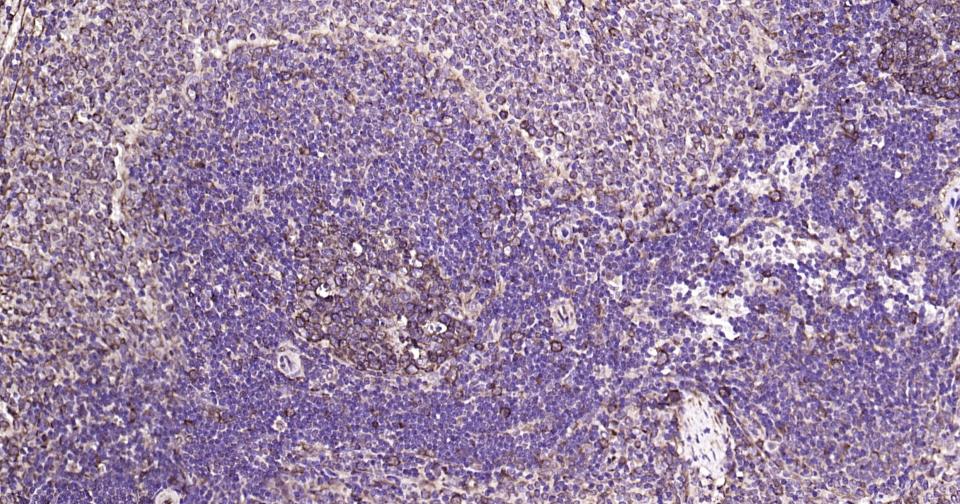 微管蛋白β1（内参）重组兔单抗