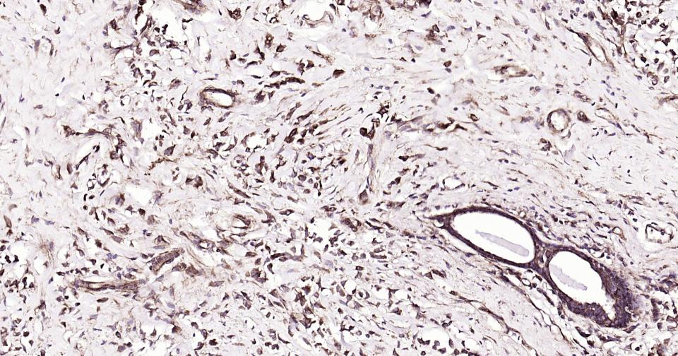 微管蛋白β1（内参）重组兔单抗