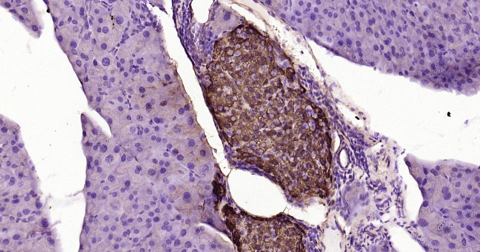 跨膜受体蛋白Notch-1重组兔单抗