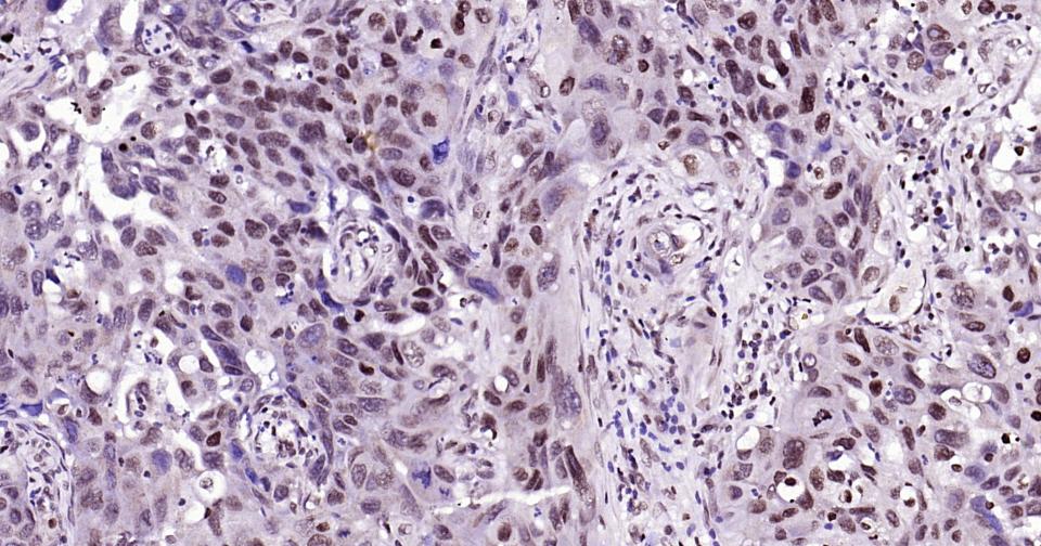 组蛋白H3（核内参）抗体-bs-0349R