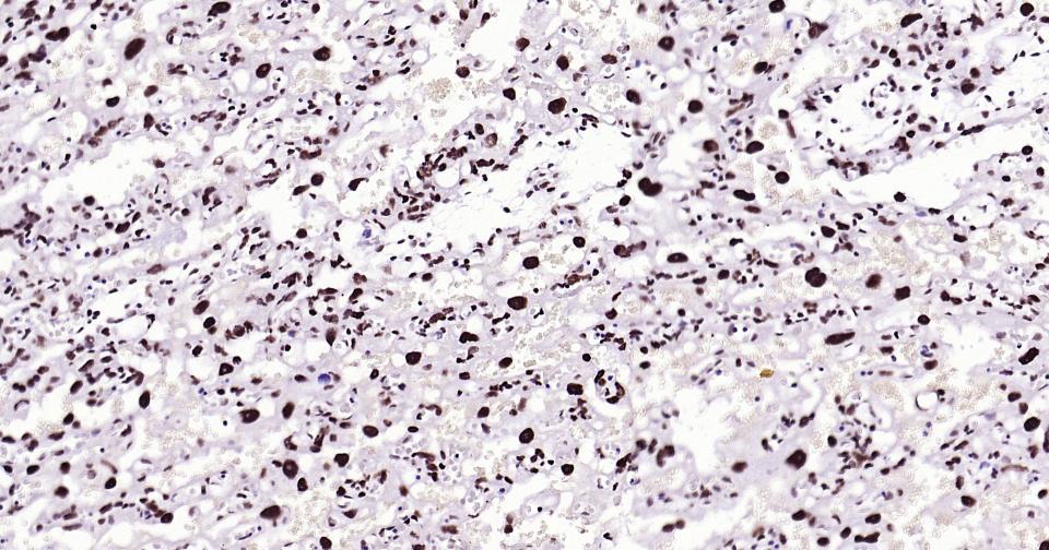 抑癌基因SNF2β重组兔单抗