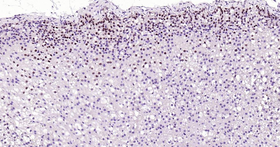胰岛素基因增强结合蛋白1重组兔单抗