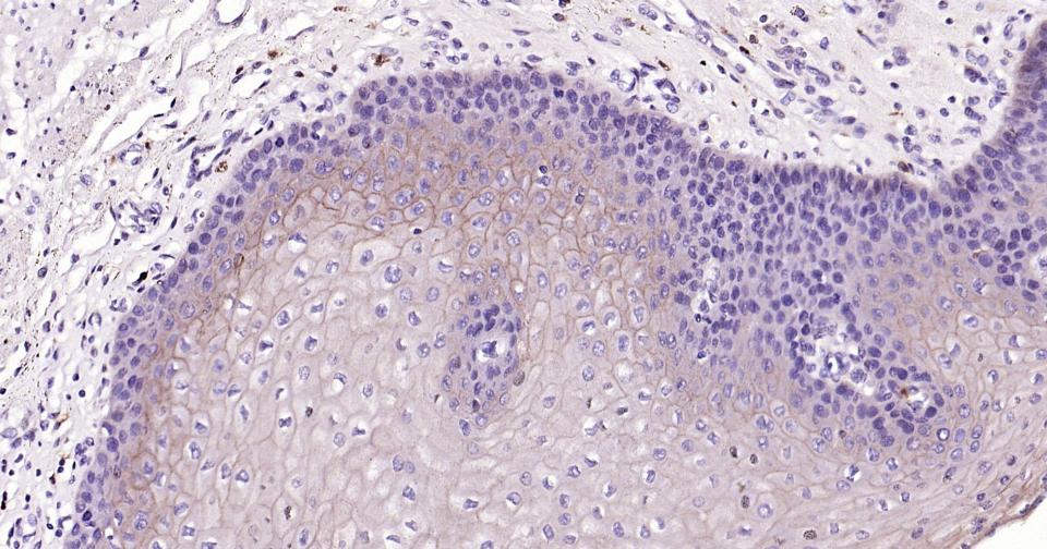 上皮钙粘附分子重组兔单克隆抗体