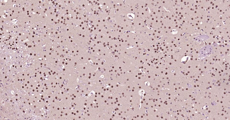 转录因子HES-1重组兔单抗-bsm-52568R