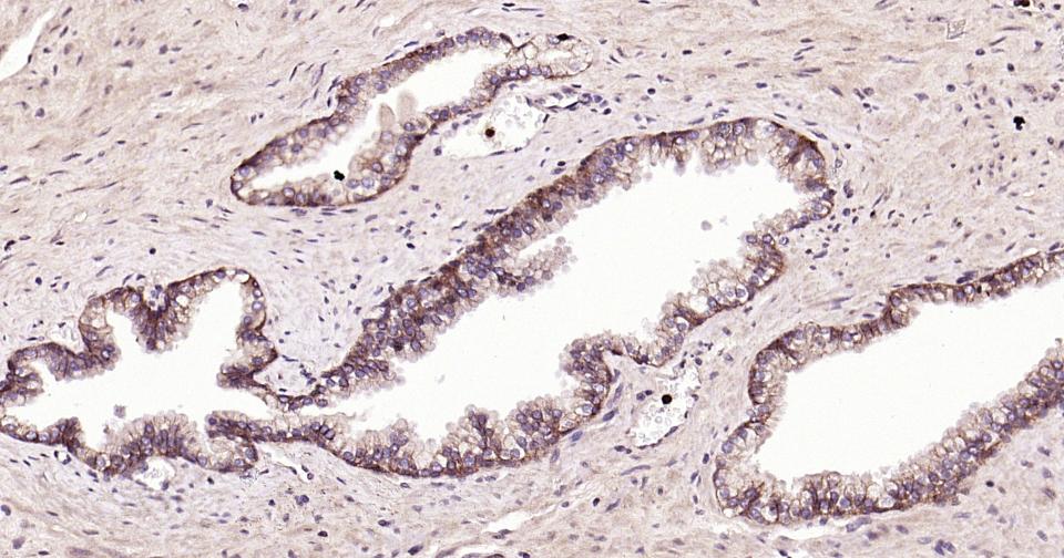 上皮钙粘附分子重组兔单克隆抗体