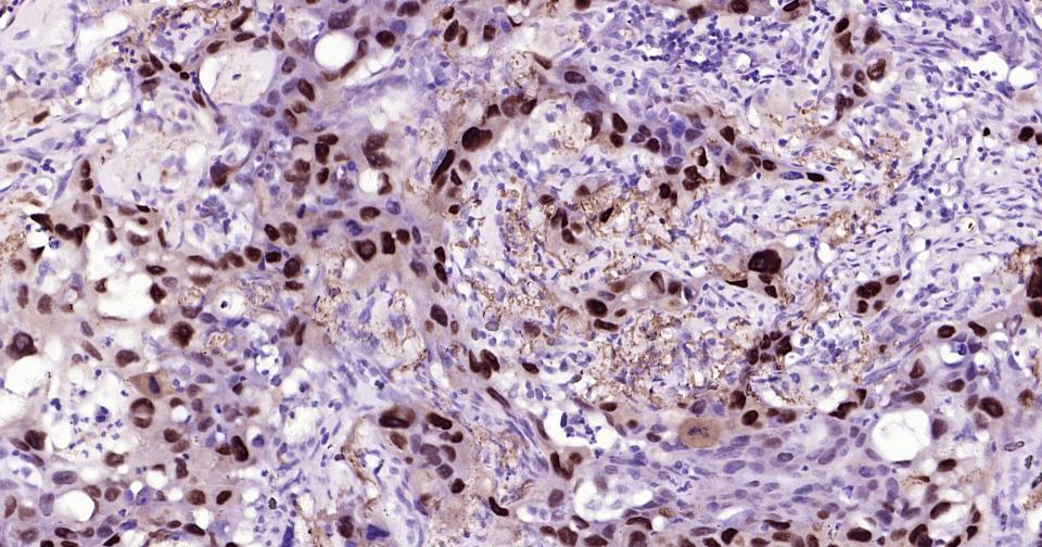 转录因子SOX9蛋白重组兔单抗