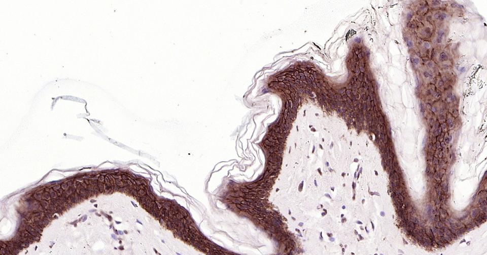 上皮钙粘附分子重组兔单克隆抗体