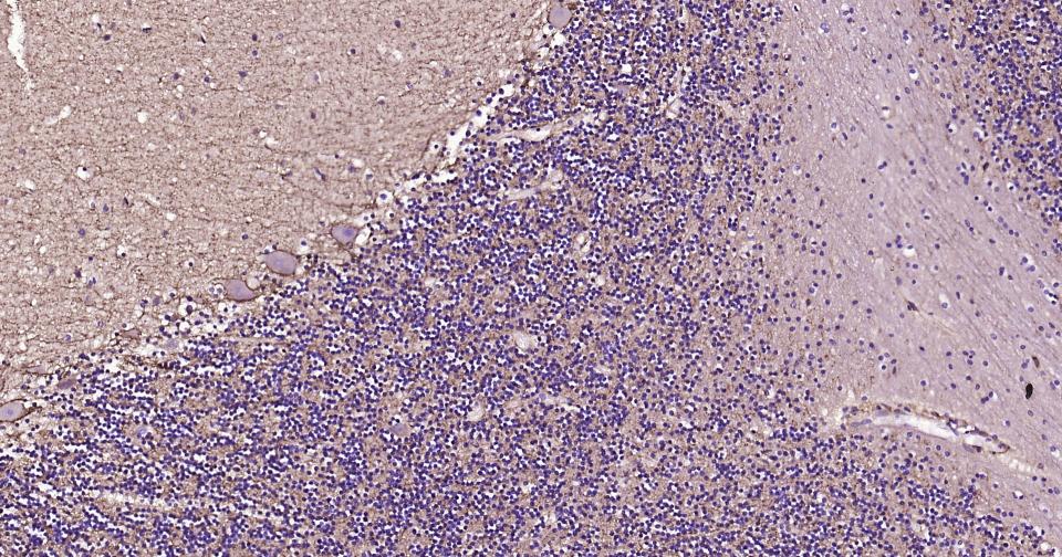 γ氨基丁酸运载蛋白1重组兔单抗