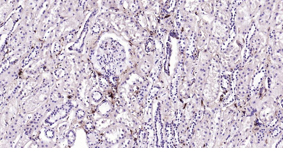 CD44抗体重组兔单抗