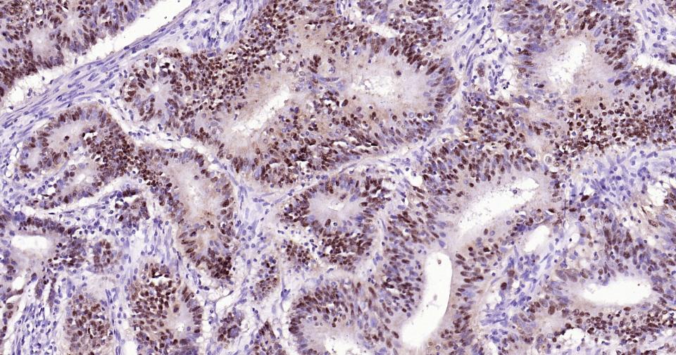 转录因子SOX9蛋白重组兔单抗