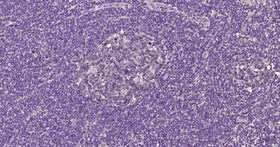 微管蛋白β1（内参）重组兔单抗