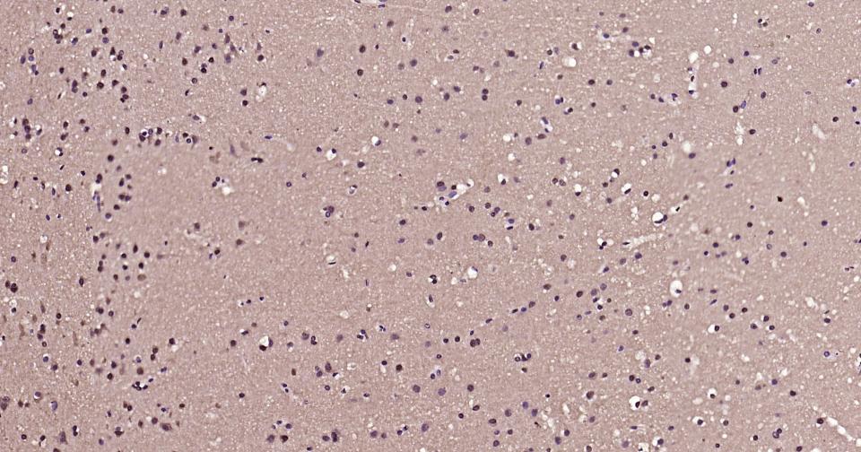 转录因子HES-1重组兔单抗-bsm-52568R