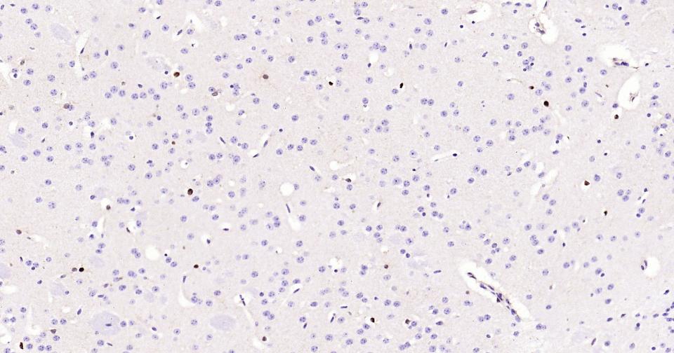 转录因子SOX9蛋白重组兔单抗