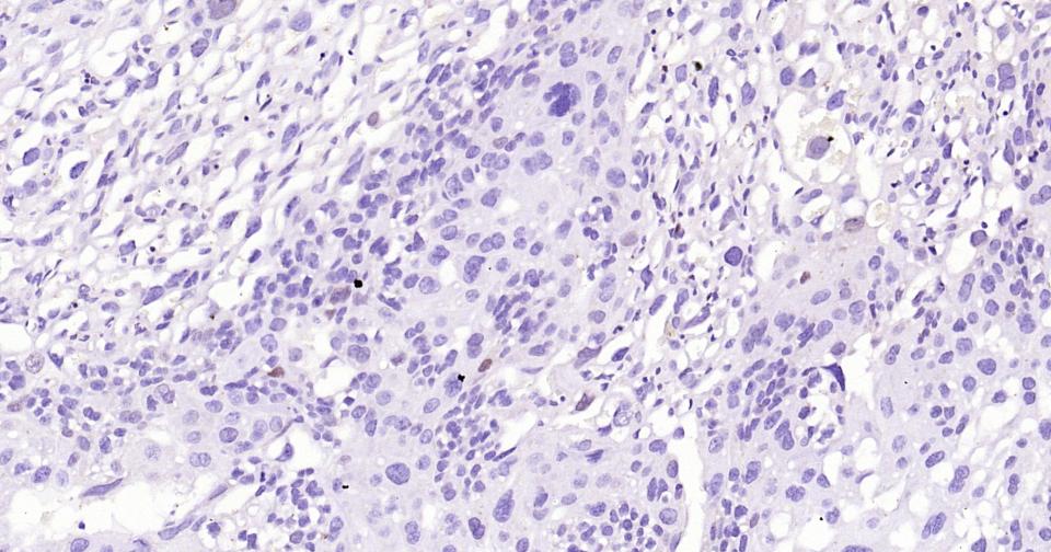 转录因子SOX9蛋白重组兔单抗