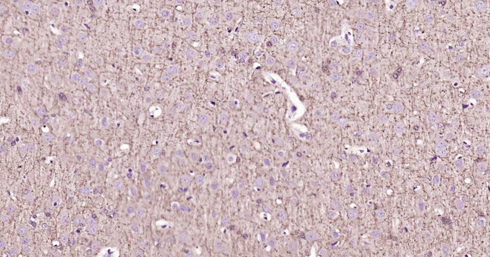 2’,3’-环腺苷酸-3’-磷酸二酯酶重组兔单抗-bsm-61411R