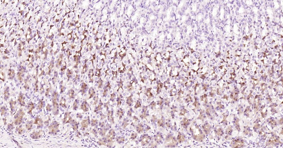 跨膜受体蛋白Notch-1重组兔单抗