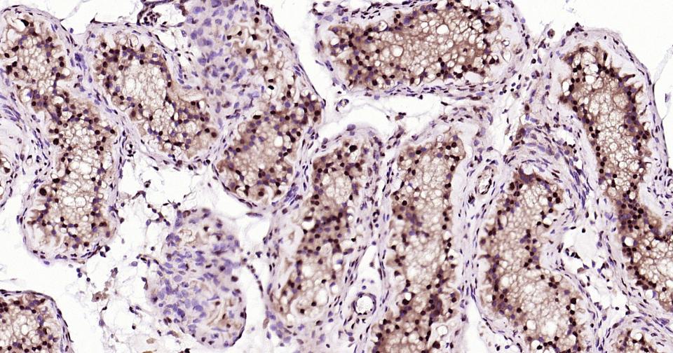 少突胶质细胞转录因子3重组兔单抗