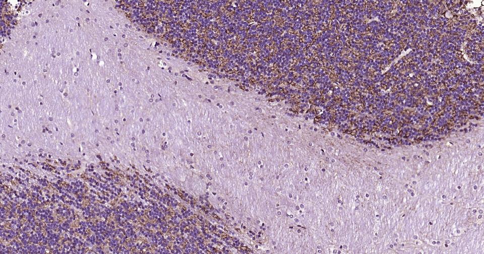 γ氨基丁酸运载蛋白1重组兔单抗