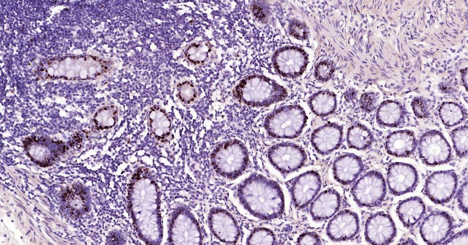 转录因子SOX9蛋白重组兔单抗