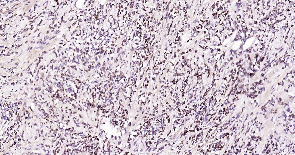 γ氨基丁酸转氨酶重组兔单抗