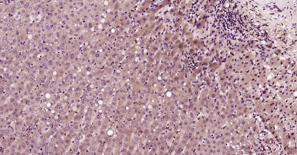 细胞核转录因子X盒结合蛋白重组兔单抗